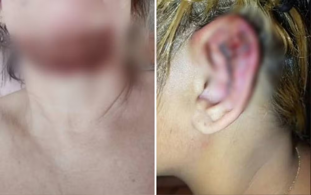 Imagem Ilustrando a Notícia: Dentista é presa por deformar rostos de pacientes em Goiânia, diz polícia
