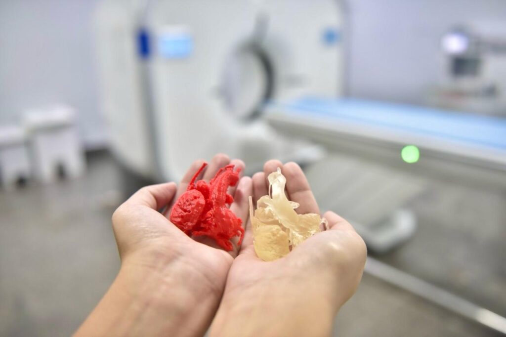 Imagem Ilustrando a Notícia: Impressão 3D de coração ajuda em cirurgias cardíacas no Hugol