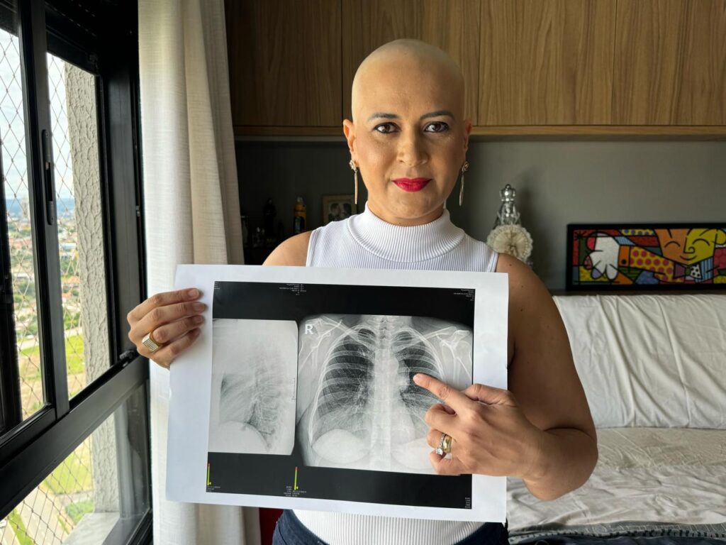 Imagem Ilustrando a Notícia: “Câncer não é sentença de morte”, diz Eva Taucci, jornalista que tirou peruca ao vivo