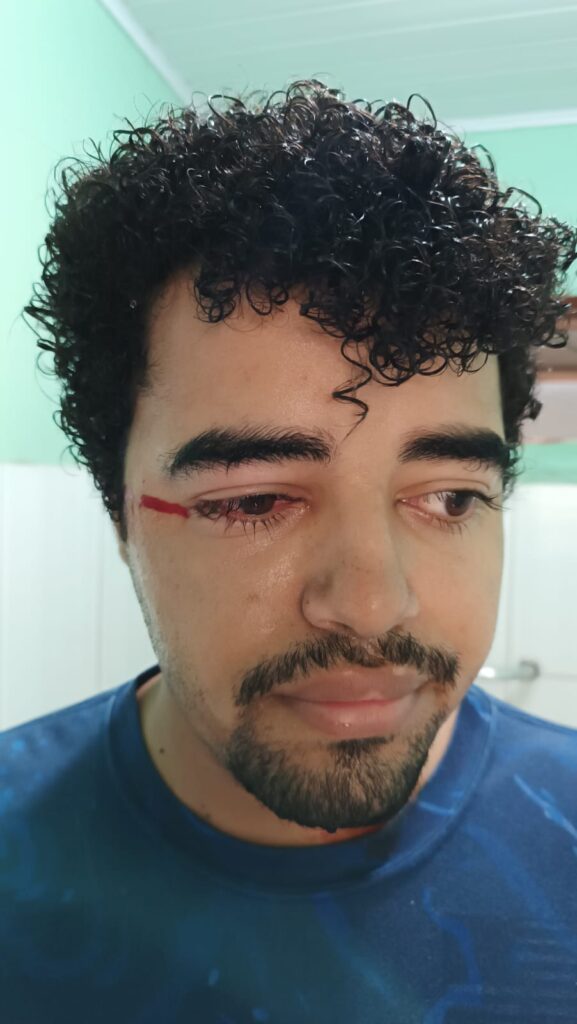 Imagem Ilustrando a Notícia: Denúncia de racismo: homem relata ter sido agredido em condomínio residencial de Goiânia; veja imagens 