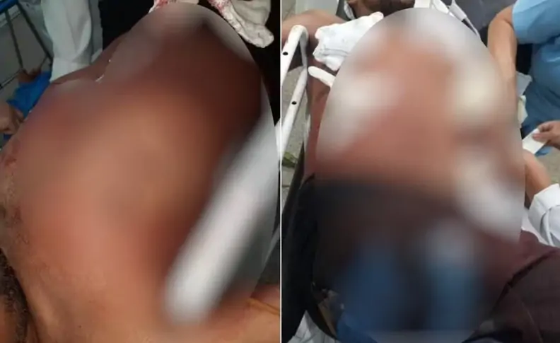 Imagem Ilustrando a Notícia: Homem morre esfaqueado após passar a mão nas nádegas de mulher em bar, diz polícia