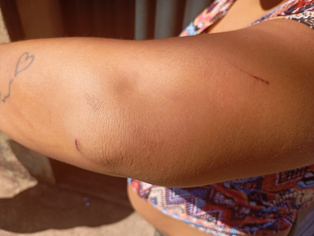 Imagem Ilustrando a Notícia: Criança de 9 anos busca ajuda após presenciar agressão do padrasto à mãe em Goiás