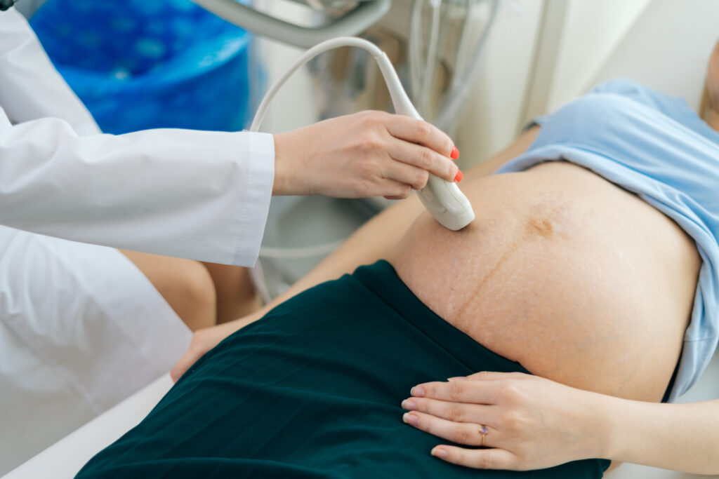 Imagem Ilustrando a Notícia: Hospital da Mulher promove mutirão de ecocardiograma fetal em Goiânia