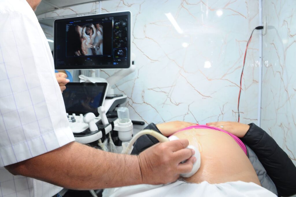 Imagem Ilustrando a Notícia: Mais de 180 gestantes fizeram ultrassonografia gratuita em Aparecida