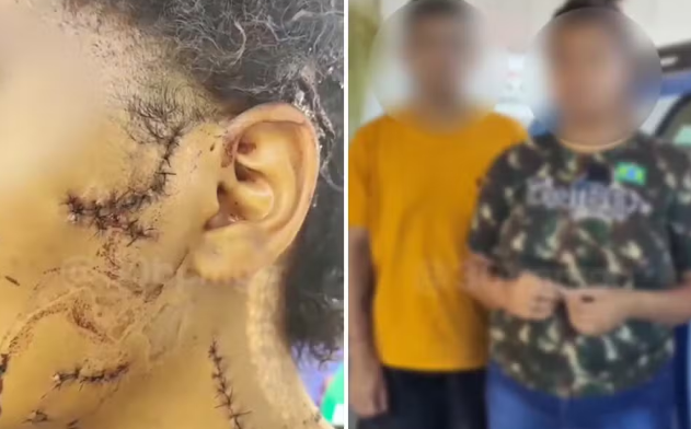 Imagem Ilustrando a Notícia: Menina de 14 anos tem o rosto mutilado por casal 