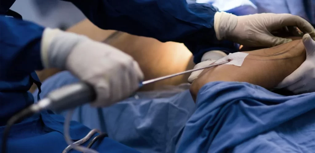 Imagem Ilustrando a Notícia: Brasil se torna o 2º país que mais realiza cirurgias plásticas no mundo