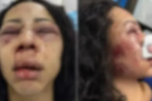 Imagem Ilustrando a Notícia: Turista brasileira sofre agressão no Chile e está em estado grave