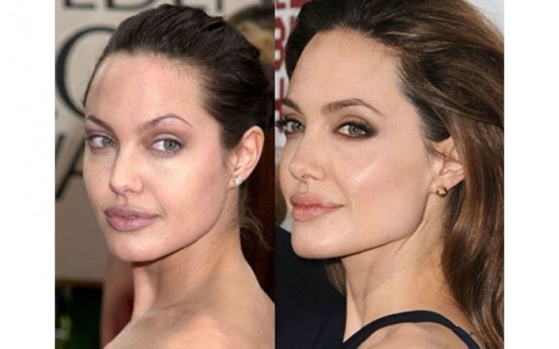 Imagem Ilustrando a Notícia: De Fofão a Angelina Jolie: que tal um rosto mais fino?