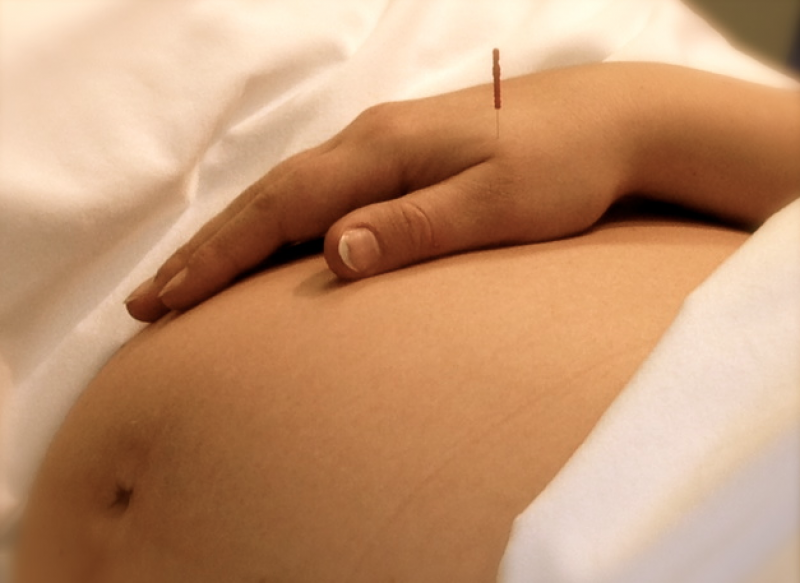 Imagem Ilustrando a Notícia: Acupuntura na gravidez ajuda no alívio de enjoos e dores lombares