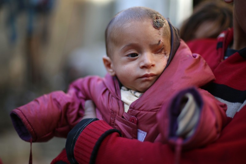 Imagem Ilustrando a Notícia: Foto de bebê que perdeu olho em bombardeio na Síria vira símbolo