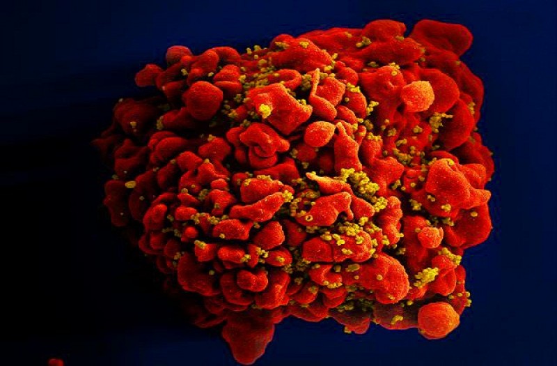 Imagem Ilustrando a Notícia: OMS alerta para mutações do vírus HIV e alta nos casos de resistência