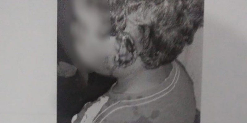 Imagem Ilustrando a Notícia: Padrasto é preso por agredir e cortar orelha de enteado de 4 anos