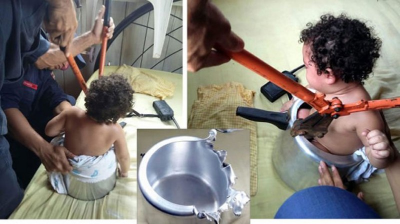Imagem Ilustrando a Notícia: Criança fica presa em panela de pressão no interior de Acre