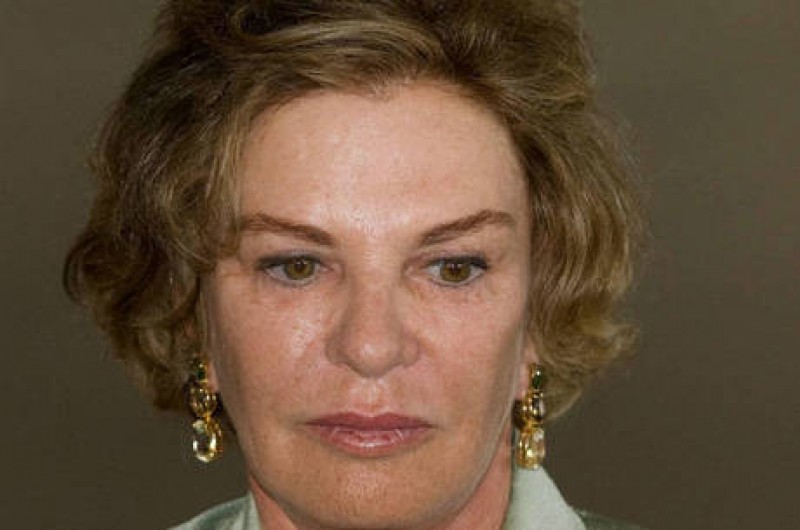 Imagem Ilustrando a Notícia: Confirmada morte cerebral da ex-primeira dama Marisa Letícia Lula da Silva