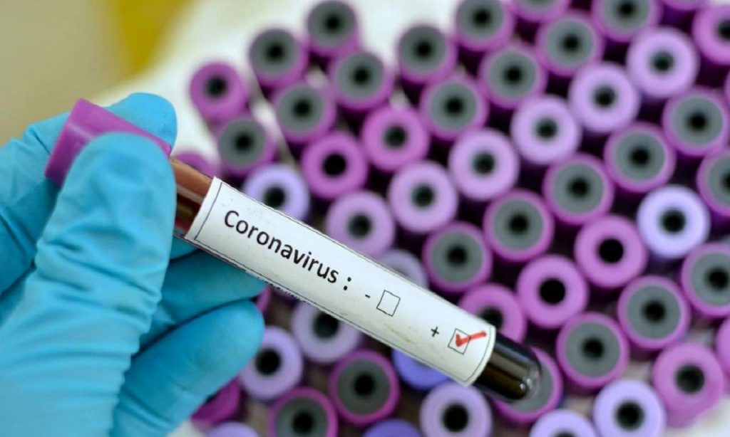 Imagem Ilustrando a Notícia: 1º caso do coronavírus em Anápolis é confirmado e casos em Goiás sobe para 7