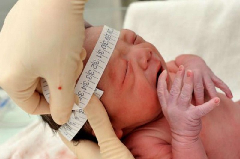 Imagem Ilustrando a Notícia: Bebês sem microcefalia são estudados