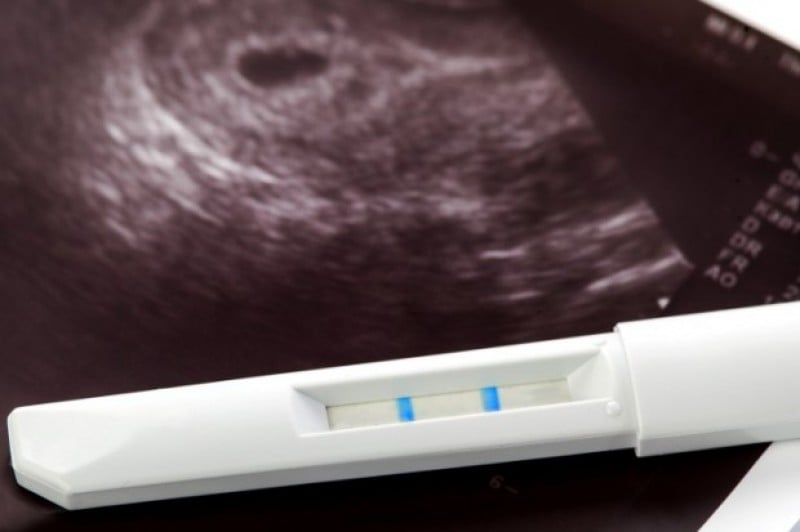 Imagem Ilustrando a Notícia: Saúde libera R$ 4,8 milhões para testes rápidos de gravidez
