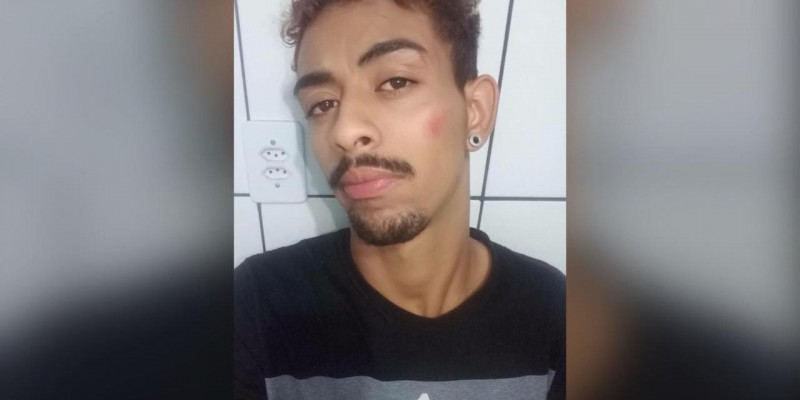 Imagem Ilustrando a Notícia: Homossexual é agredido em porta de boate em Goiânia