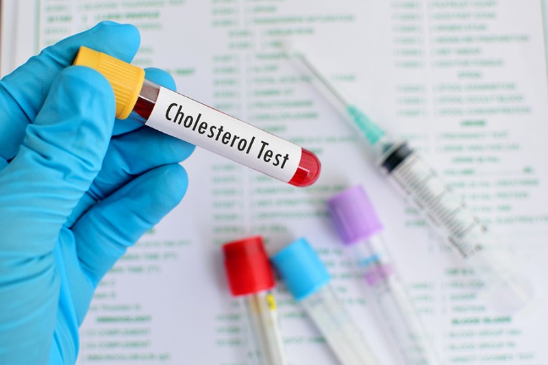 Imagem Ilustrando a Notícia: Taxas mais rígidas para controle de colesterol passam a ser adotadas