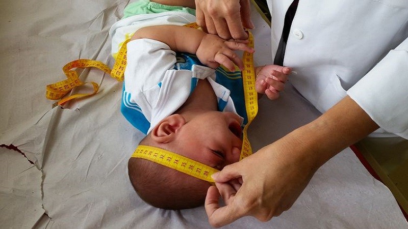 Imagem Ilustrando a Notícia: Mães de bebês com microcefalia vivem novos desafios