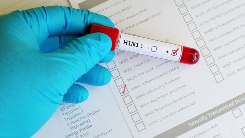 Imagem Ilustrando a Notícia: Síndrome causada por H1N1 mantém três em UTI