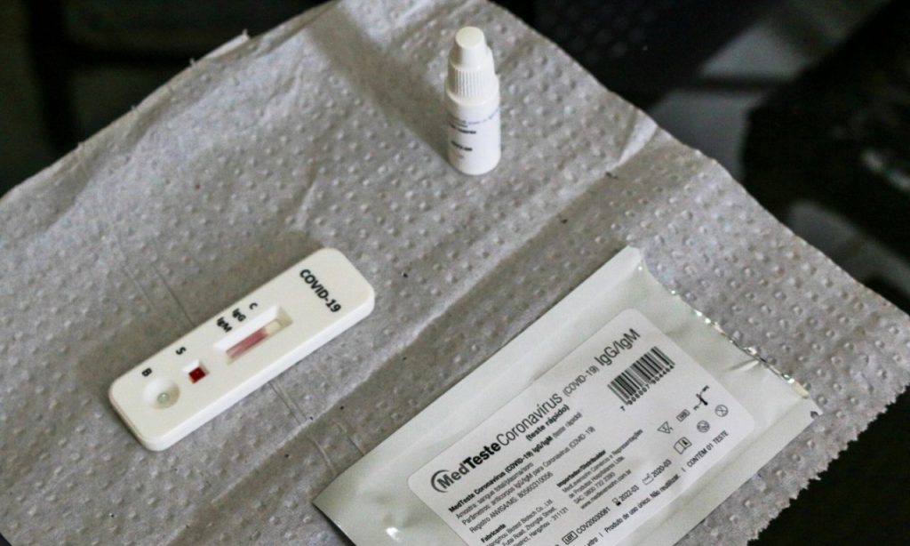 Imagem Ilustrando a Notícia: Anvisa autoriza farmácias a realizarem testes rápidos para diagnosticar Covid-19