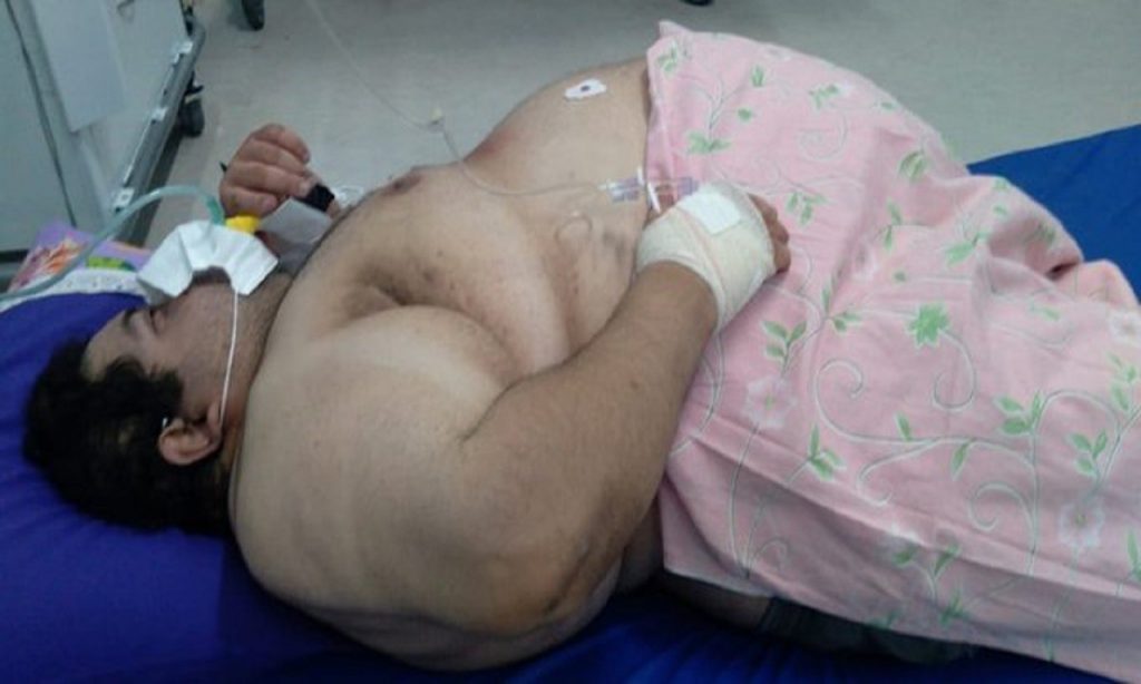 Imagem Ilustrando a Notícia: Morre homem com quase 300 quilos esperando por UTI há 5 dias