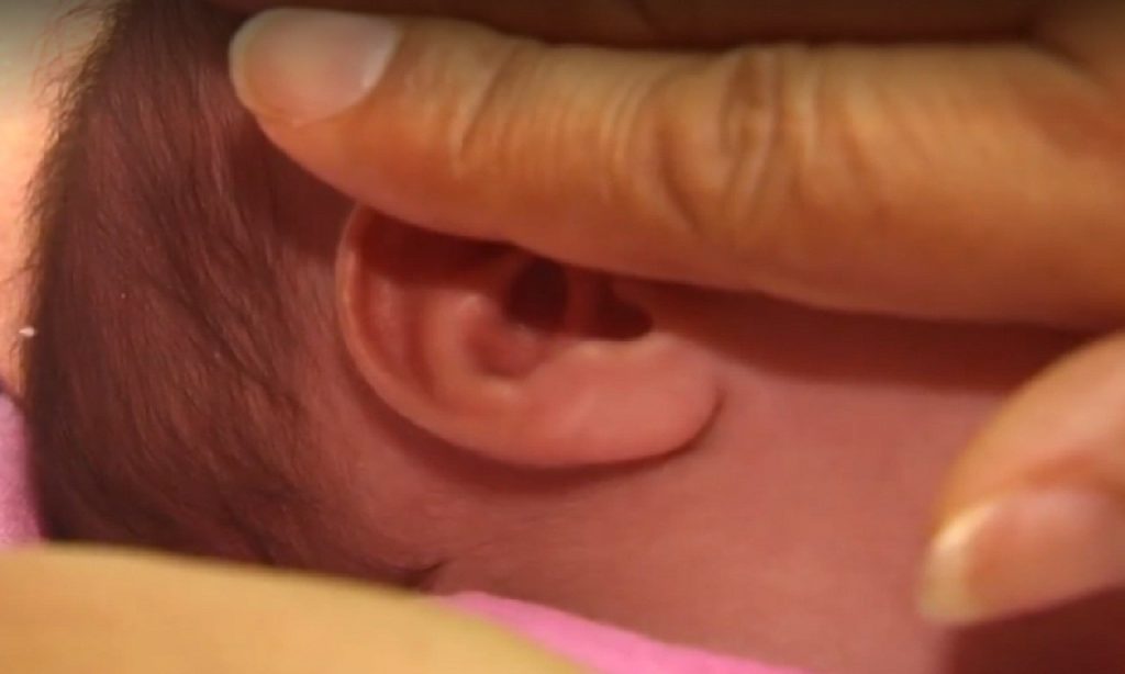 Imagem Ilustrando a Notícia: Hospital Materno Infantil realizará mais uma cirurgia de separação