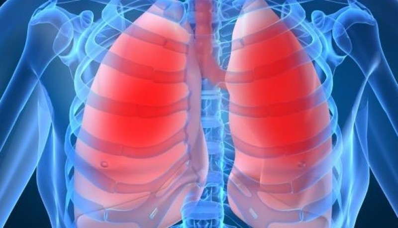 Imagem Ilustrando a Notícia: Anvisa aprova medicamento para hipertensão arterial pulmonar