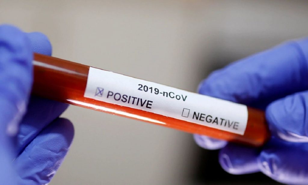 Imagem Ilustrando a Notícia: Secretaria de Estado de Saúde confirma o segundo caso do novo coronavírus no RJ