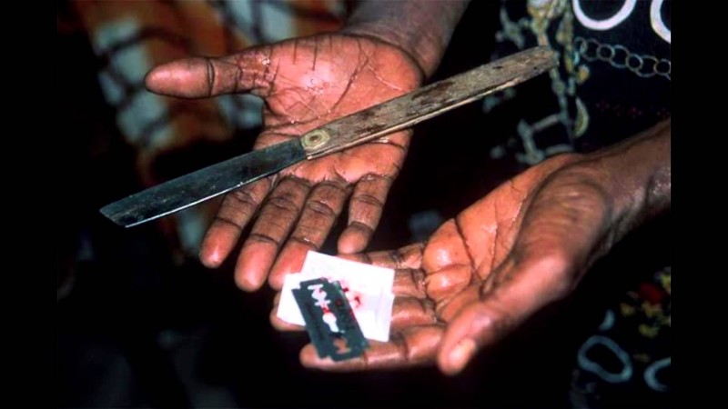 Imagem Ilustrando a Notícia: 200 milhões de mulheres sofrem mutilação genital