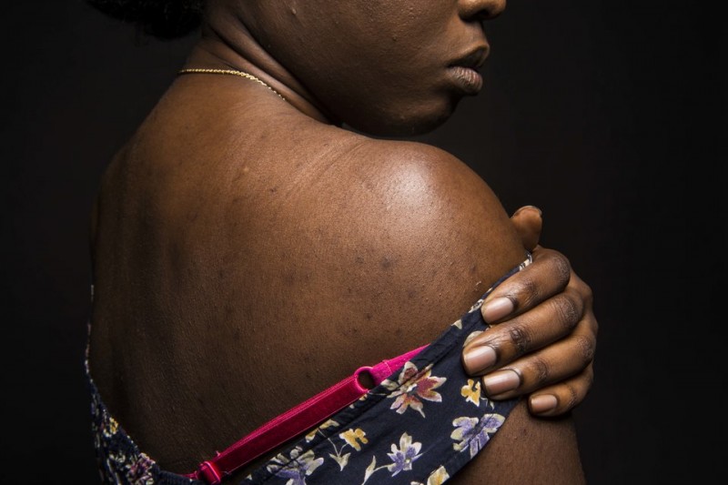 Imagem Ilustrando a Notícia: Mulheres negras vítimas de violência denunciam casos à OEA