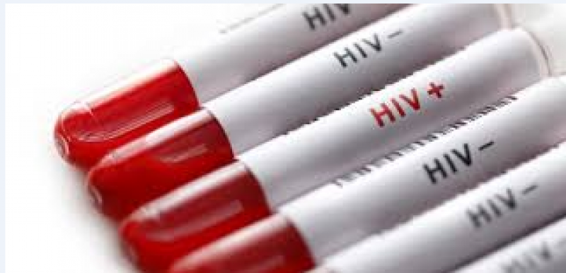 Imagem Ilustrando a Notícia: Aumenta 50% de casos de HIV entre os  goianos