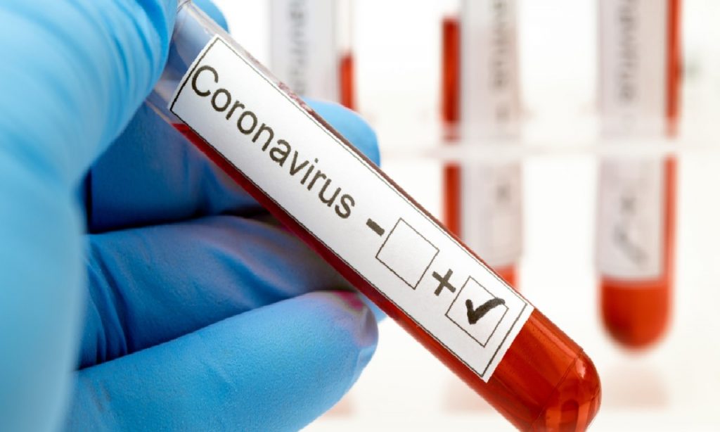 Imagem Ilustrando a Notícia: OMS convoca reunião sobre nova variante do coronavírus