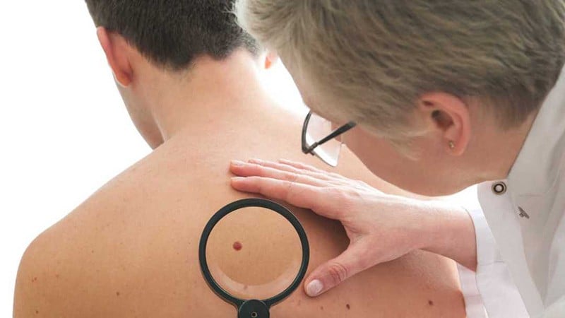Imagem Ilustrando a Notícia: Homens possuem maior propensão a desenvolverem doenças de pele