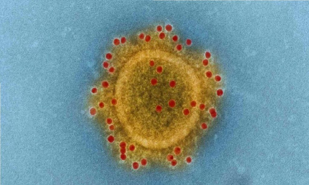 Imagem Ilustrando a Notícia: Número de casos confirmados do novo coronavírus ultrapassa 85,5 mil