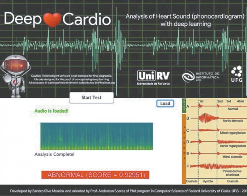 Imagem Ilustrando a Notícia: UFG desenvolve método simples e barato para diagnosticar problemas cardiovascula