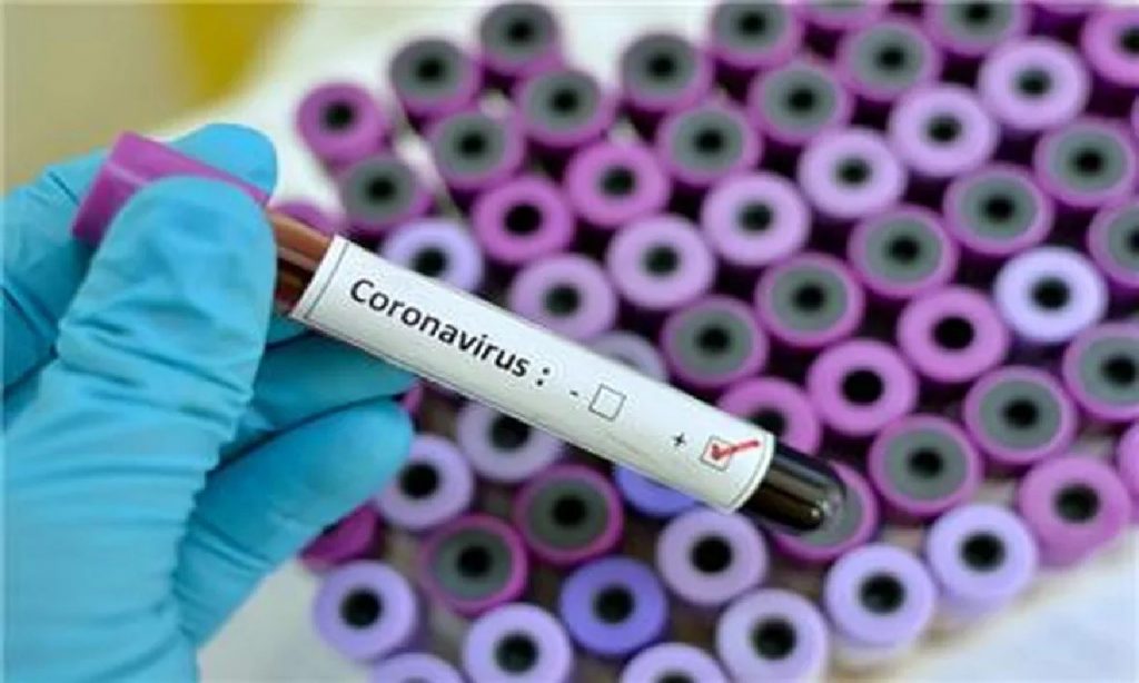 Imagem Ilustrando a Notícia: Goiás registra 35 casos confirmados de contaminados por coronavírus