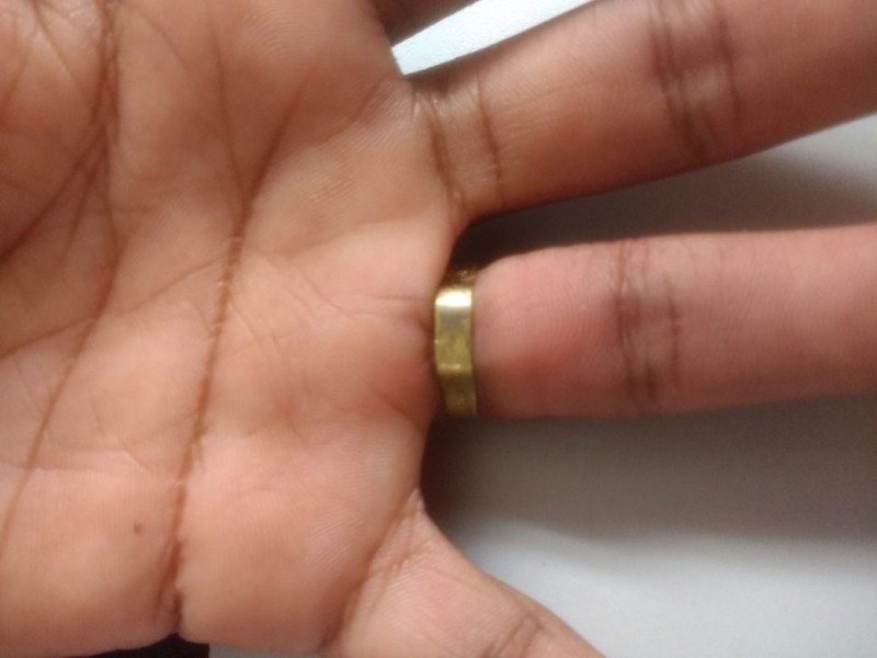 Imagem Ilustrando a Notícia: Bombeiros de Ceres retiram anel preso em dedo de adolescente