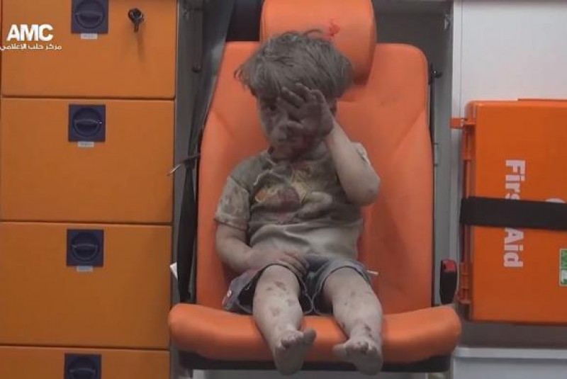 Imagem Ilustrando a Notícia: Imagem de criança ferida após ataque em Aleppo choca o mundo