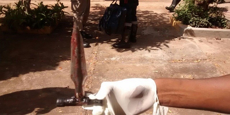 Imagem Ilustrando a Notícia: Homem mata namorada com perfurador de coco no Jardim Novo Mundo