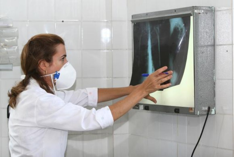 Imagem Ilustrando a Notícia: Brasil se aproxima de padrão positivo de combate à tuberculose