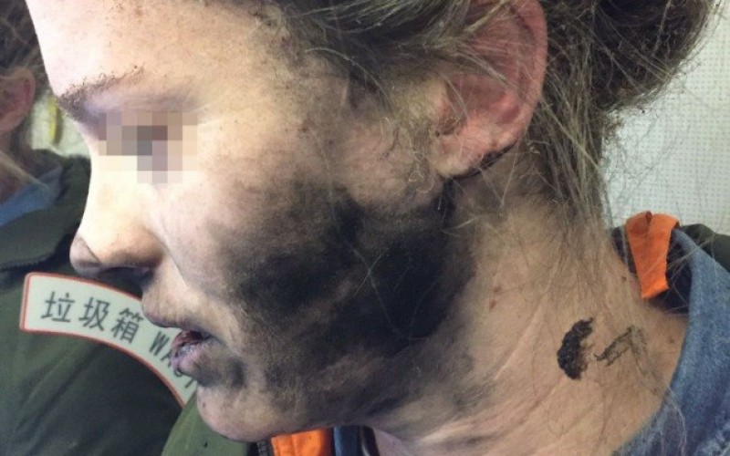 Imagem Ilustrando a Notícia: Fone de ouvido explode durante voo e fere passageira na Austrália