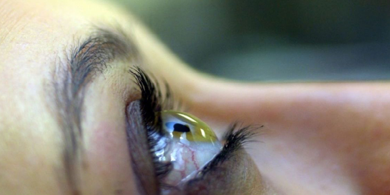 Imagem Ilustrando a Notícia: Maioria dos casos de cegueira é reversível, segundo CBO