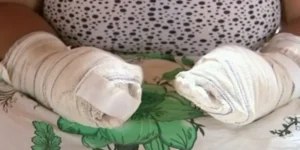 Jovem, de 20 anos, se fingiu de morta para escapar das agressões. Ela teve vários ferimentos na cabeça, perdeu dois dedos e não consegue mexer as mãos devido às lesões