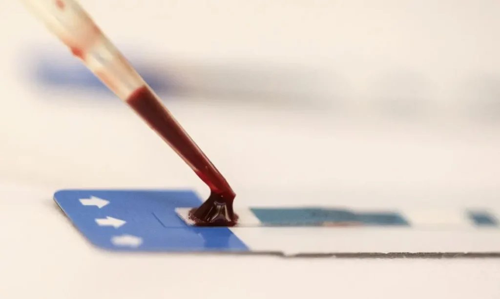 Teste de HIV