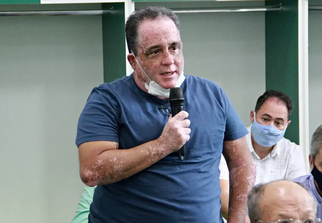 Edminho Pinheiro, relembrou a sequência de dez jogos sem perder do treinador esmeraldino | foto: Rosiron Rodrigues / Goiás EC
