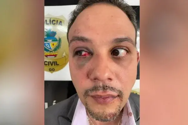 Cinco policiais foram denunciados e tiveram a posse de arma suspensa. | Foto: Reprodução