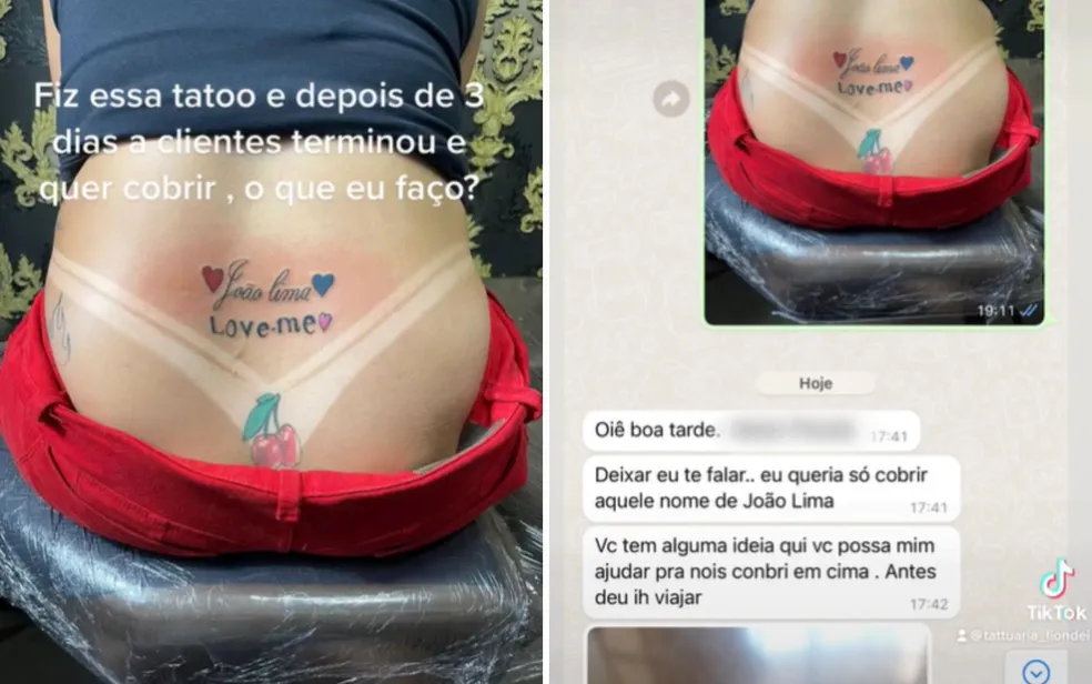 Mulher tatua nome do namorado, termina três dias depois e pede ajuda a tatuador para remover, em Goiânia