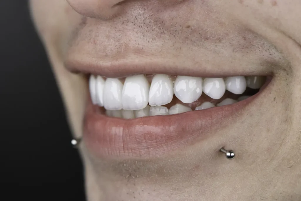 Com a crescente demanda, também surgem diversos mitos e verdades que cercam esse procedimento. | Foto: Reprodução